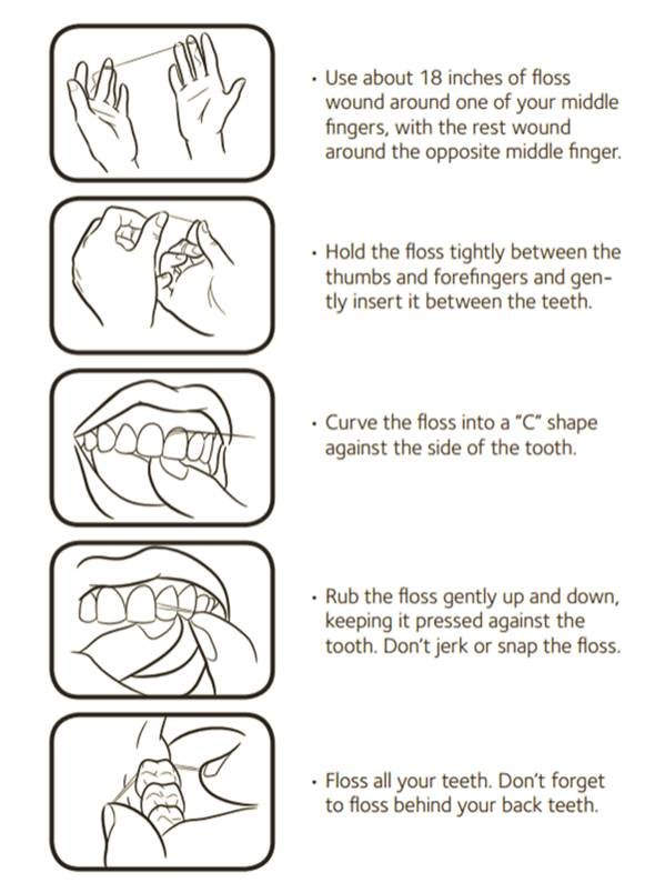 flossing technique