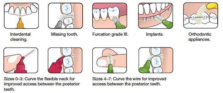 Interdental Brushing Technique