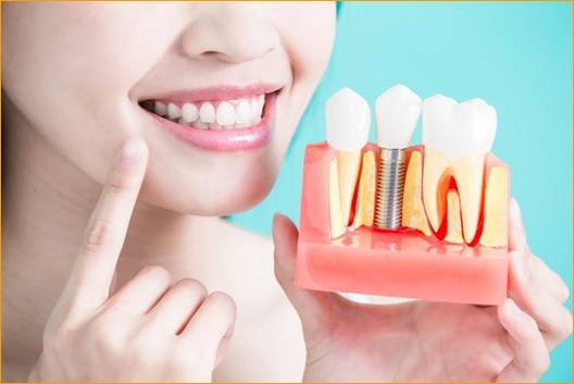 Advanced Cosmetic Dentistry Dental Implants