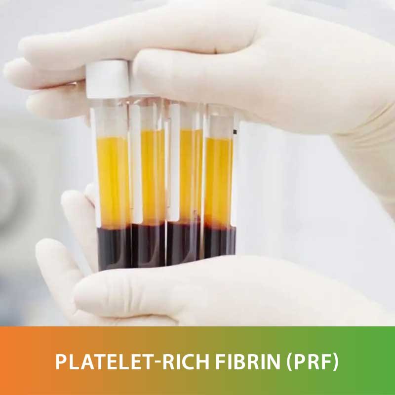 Advanced Dental Technology Platelet Rich Fibrin