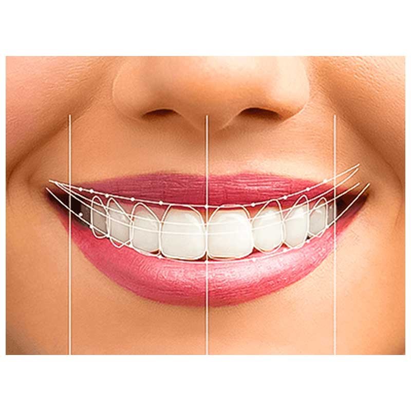 Advanced Digital Smile Designing