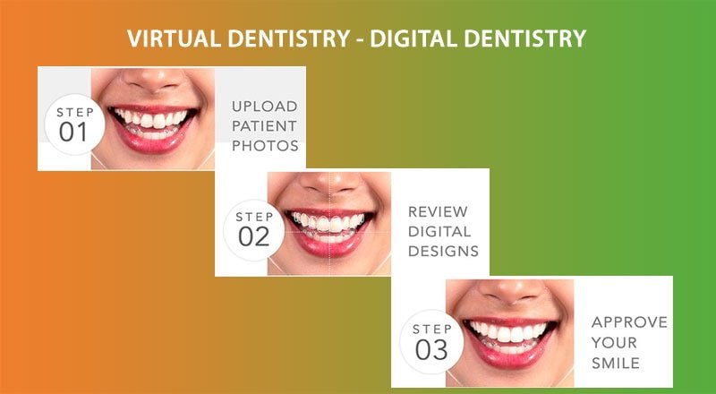 Digital Smile Designing